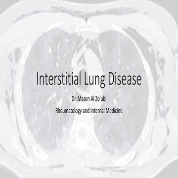 Interstitial Lung Disease | PPTX