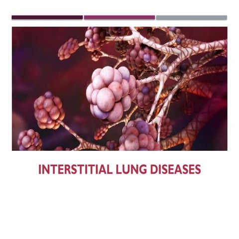 Comprehensive Overview of Interstitial Lung Diseases: Pathogenesis ...