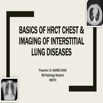 Interstitial lung disease and Occupational lung disease HRCT