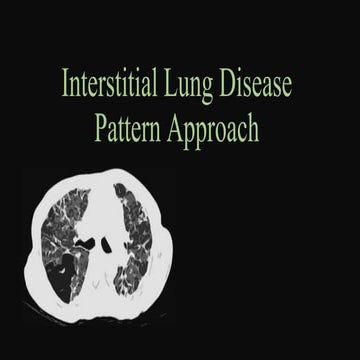 INTERSTITIAL LUNG DISEASE  Pattern Approach main.pptx