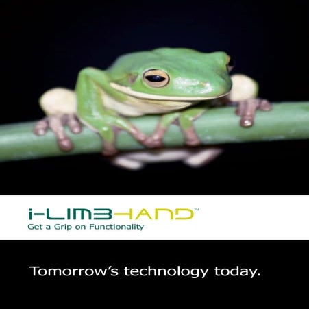 i-LIMB Bionic Hand