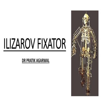 ILIZAROV  EXTERNAL FIXATOR