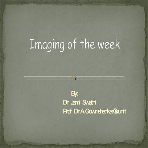 CXR: Superior vena caval syndrome