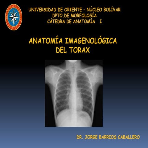 Interpretacion de radiografia PA de torax o tele de torax | PDF