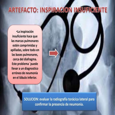 Imagenologia 4to AñoCalero