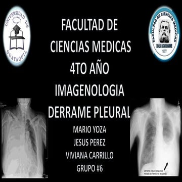 Imagenologia derrame pleural