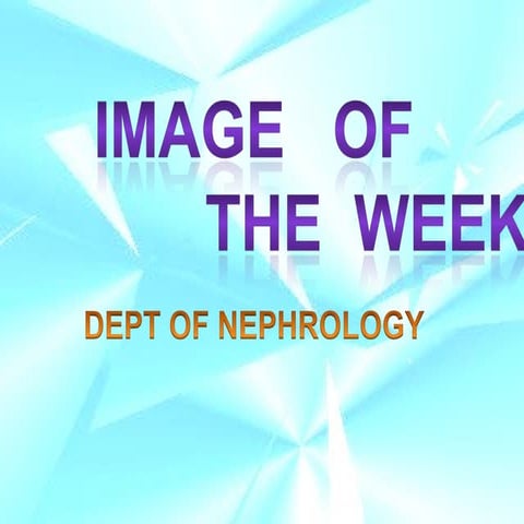 Imaging: Multiple Pulmonary Cavitary Lesions