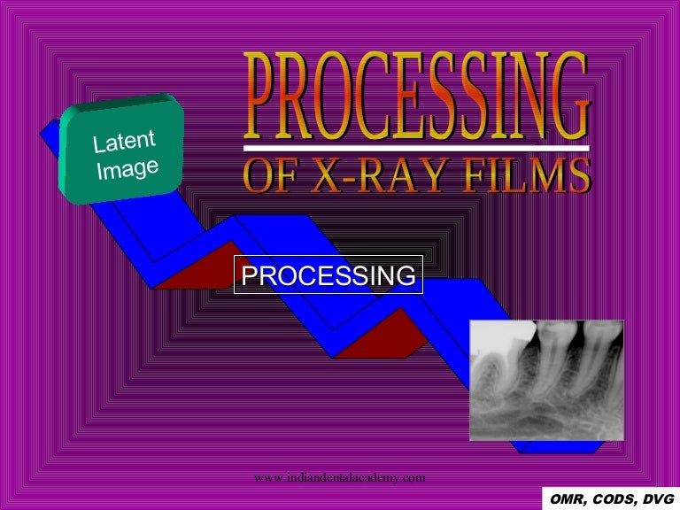 xray Image processing