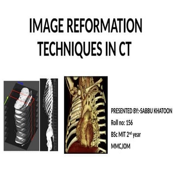 IMAGE REFORMATION TECHNIQUES IN CT-SABBU.pptx