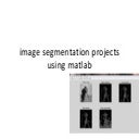 Image segmentation projects using matlab