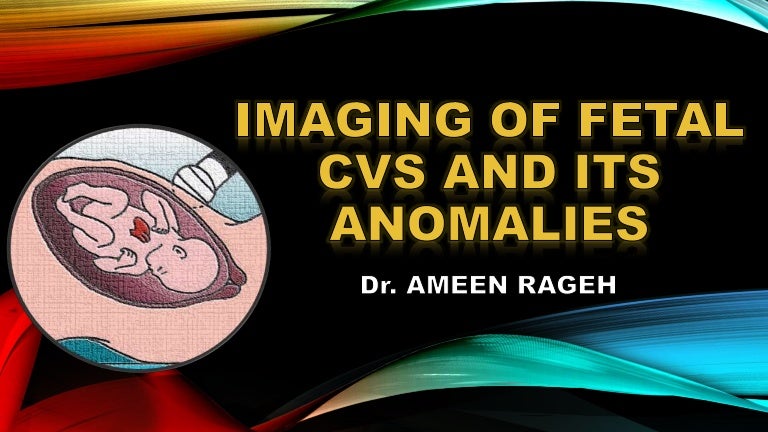 baby heart doppler cvs