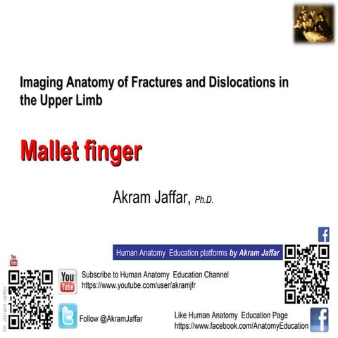 Imaging anatomy   mallet finger