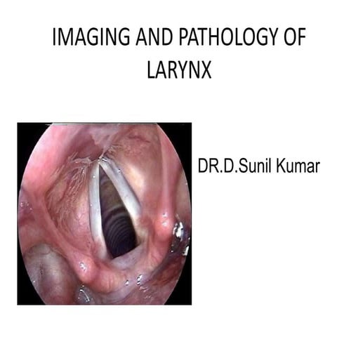 Imaging and pathology of larynx (2)