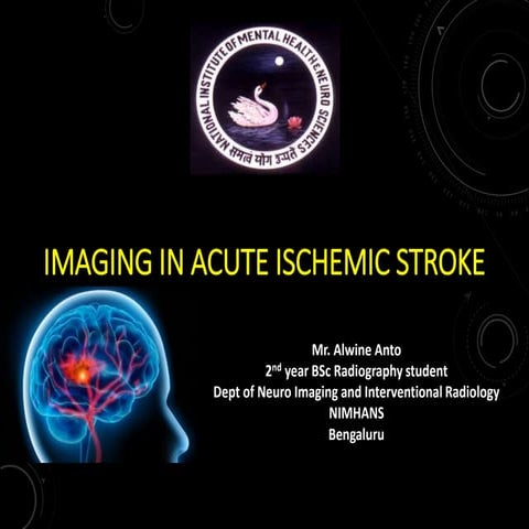 Imaging in acute stroke 
