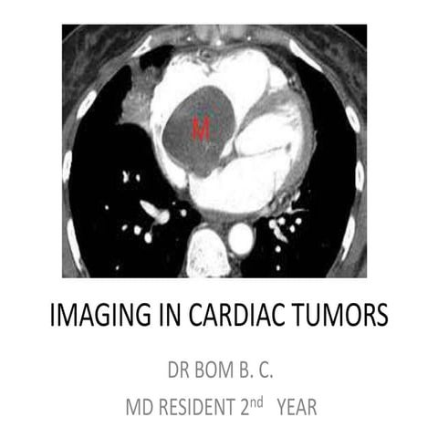 Imaging in Cardiac Tumours