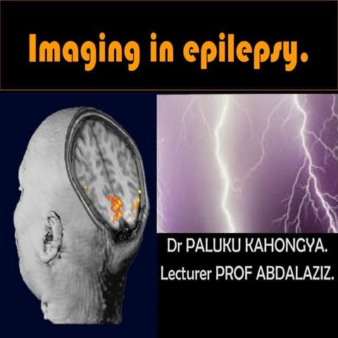 Presentation1.pptx. radiological imaging of epilepsy. | PPTX