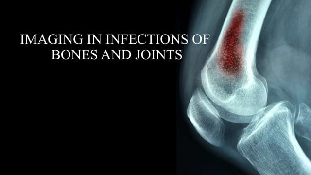 Imaging in rickets | PPTX
