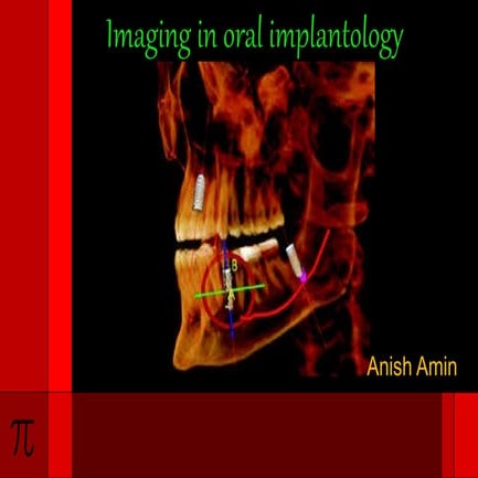 Imaging in oral implantology