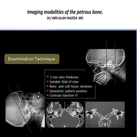 Imaging modalities of the petrous bone
