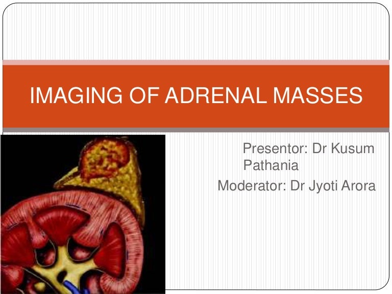 Imaging of adrenal masses