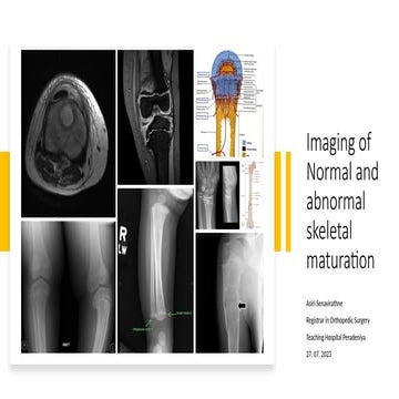 Comprehensive Imaging of Normal and Abnormal Skeletal Maturation in ...