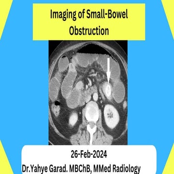 Radiological Imaging of Small-Bowel Obstruction