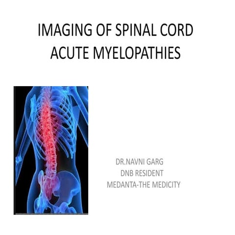 Imaging of spinal cord acute myelopathies | PPTX