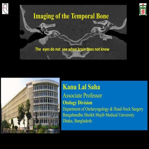 Imaging of the temporal bone 
