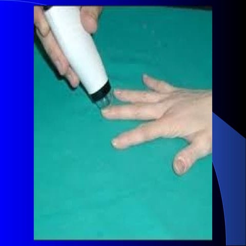 Immagini capillaroscopia. Dott. Mauro Zanocchi