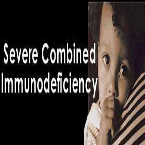 severe combined immunodeficiency