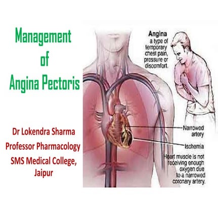Management of Angina Pectoris | PPT