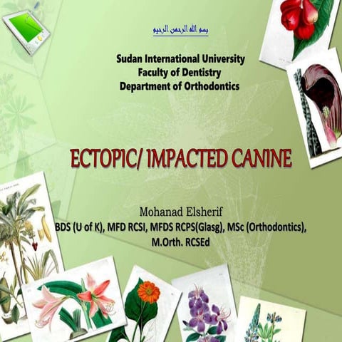 Impacted canine