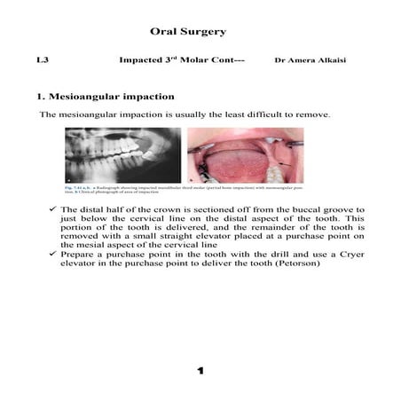 Impacted lower and upper 3rd molar lecture