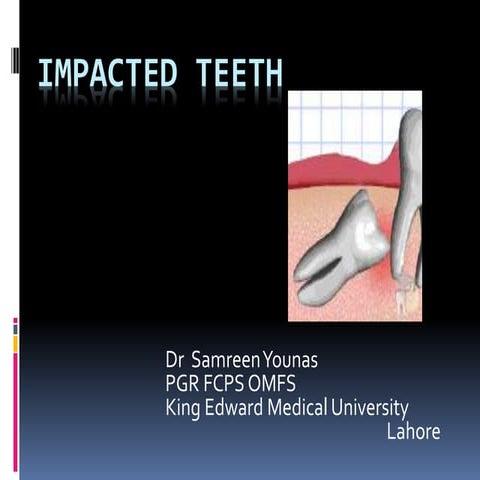 Impacted teeth