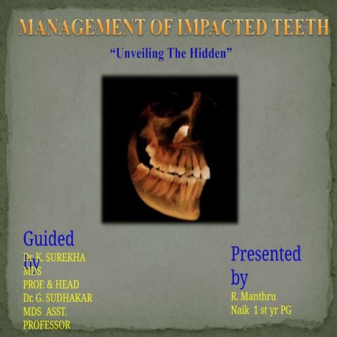 Impacted teeth in oral and maxillofacial surgery.pptx