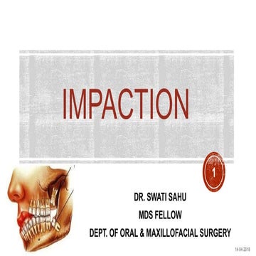 Impaction