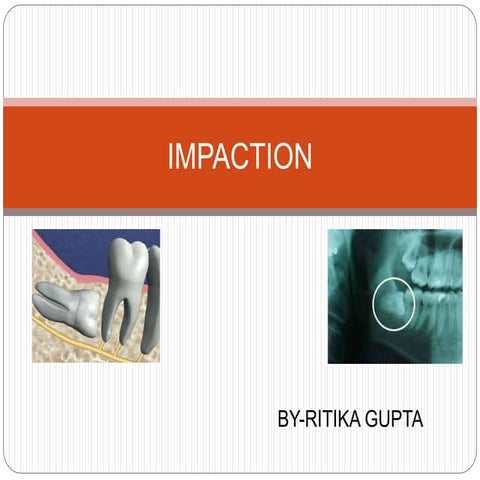 Impaction