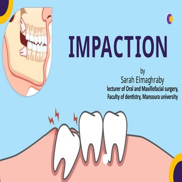 Impaction of mandibular 3rd molar | PPTX