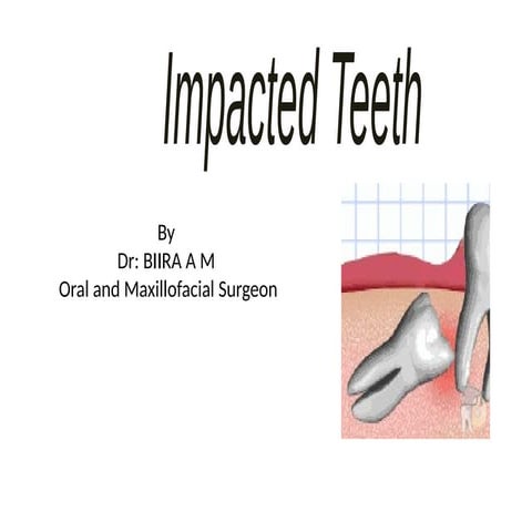 impaction their types and their different form of treatment and investigation...