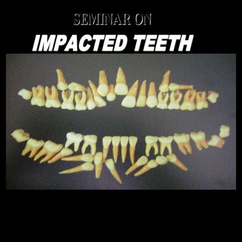 IMPACTION pic PPT.ppt