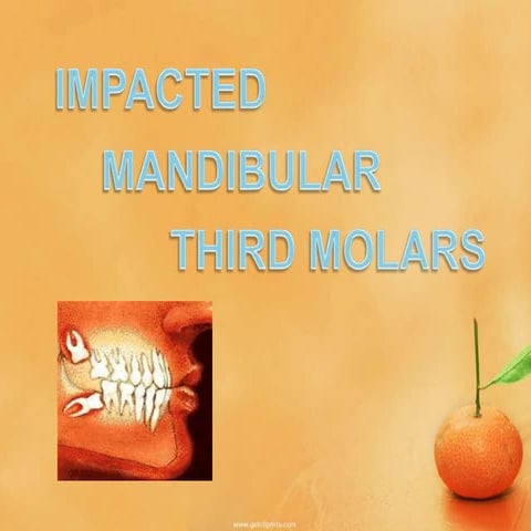 mandibular molar Impactions