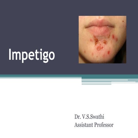 Impetigo