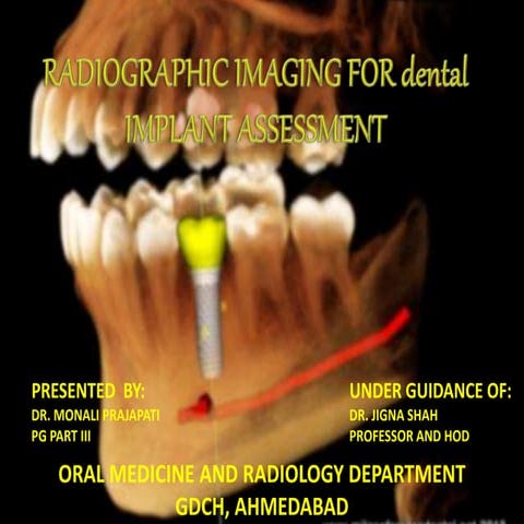 RADIOGRAPHIC IMAGING FOR DENTAL IMPLANT ASSESSMENT