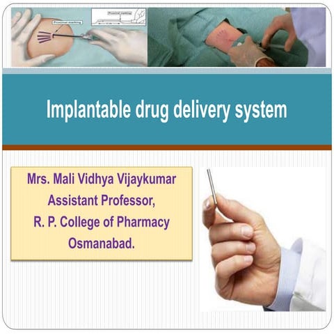 Implantable dds ppt mali vv