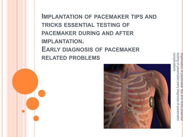 Transcutaneous Pacing | PPT
