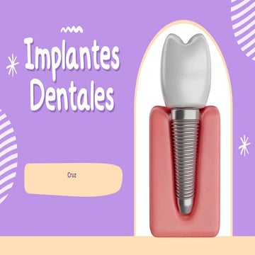 Presentación de  Implantes Dentales .pdf