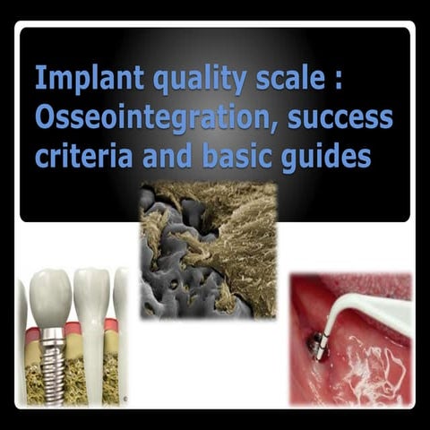 Implant quality scale ; osseointegration, success criteria and basic guides