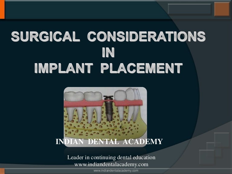 Dental Implants surgical considerations / implant dentistry course/ i…