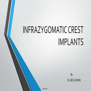 Infra-zygomatic Crest implants (IZC)