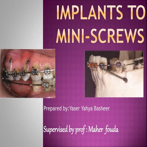 Implants to miniscrews